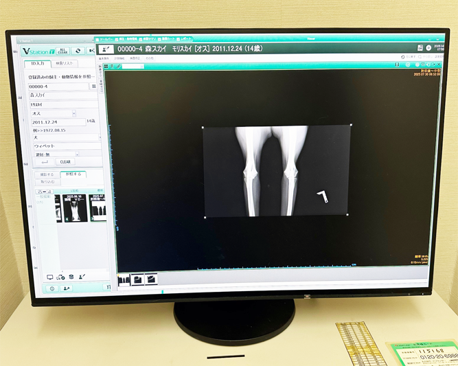 デジタルレントゲン