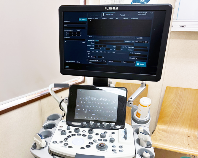 超音波検査装置