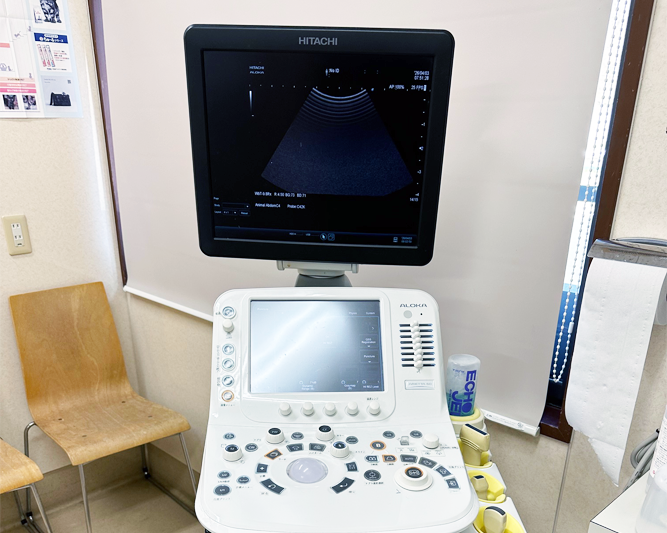 超音波検査装置