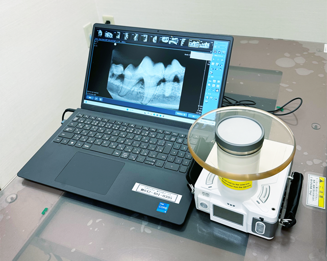 歯科用レントゲン